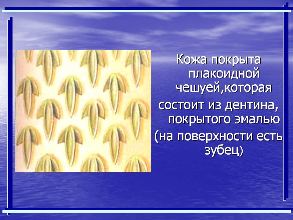 Кожа покрыта плакоидной чешуей,которая состоит из дентина, покрытого