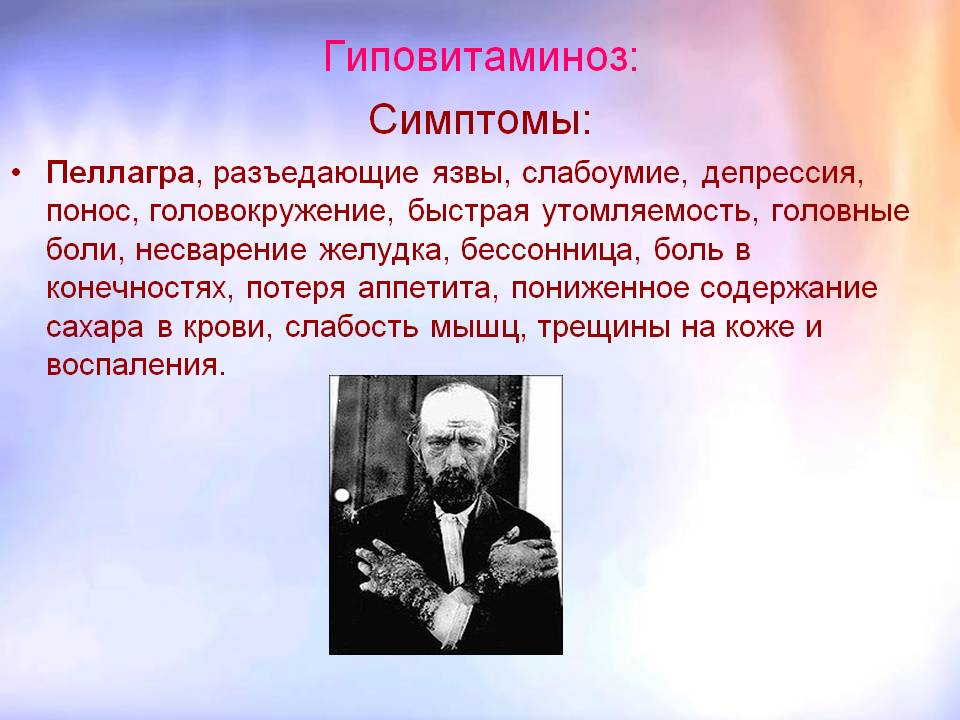 Пеллагра