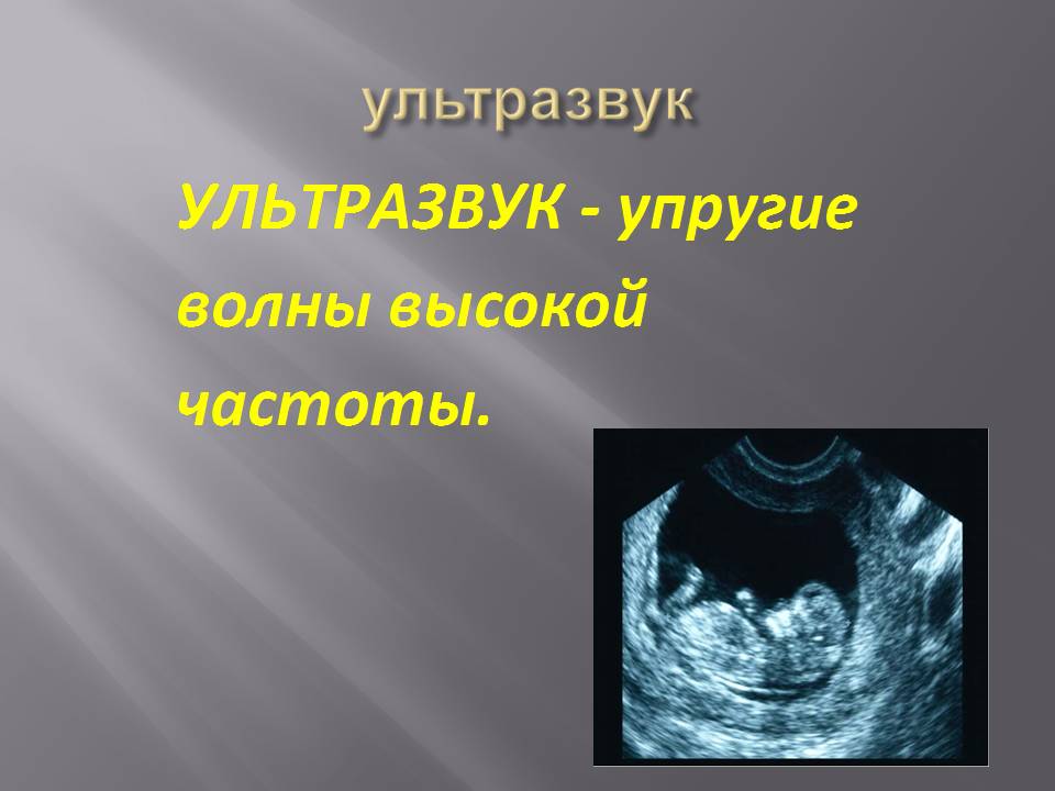 Ультразвук