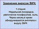 Заражение вирусом ВИЧ: 1 стадия: Недельная лихорадка, увеличение