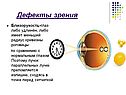 Дефекты зрения
