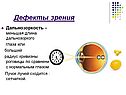 Дефекты зрения
