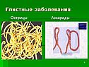 Глистные заболевания