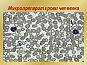 Микропрепарат крови человека