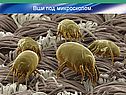 Вши под микроскопом