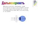 Дальнозоркость